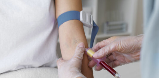 Véradási események Bács-Kiskun vármegyében a 13. héten